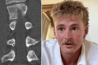 ‘A Miracle or Insane Rapid Recovery?’—Forrest Frank Shows Evidence of a