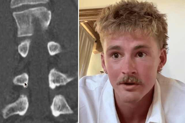 Forrest Frank x-rays